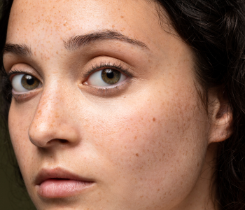 DAMAGED & SENSITIVE SKIN